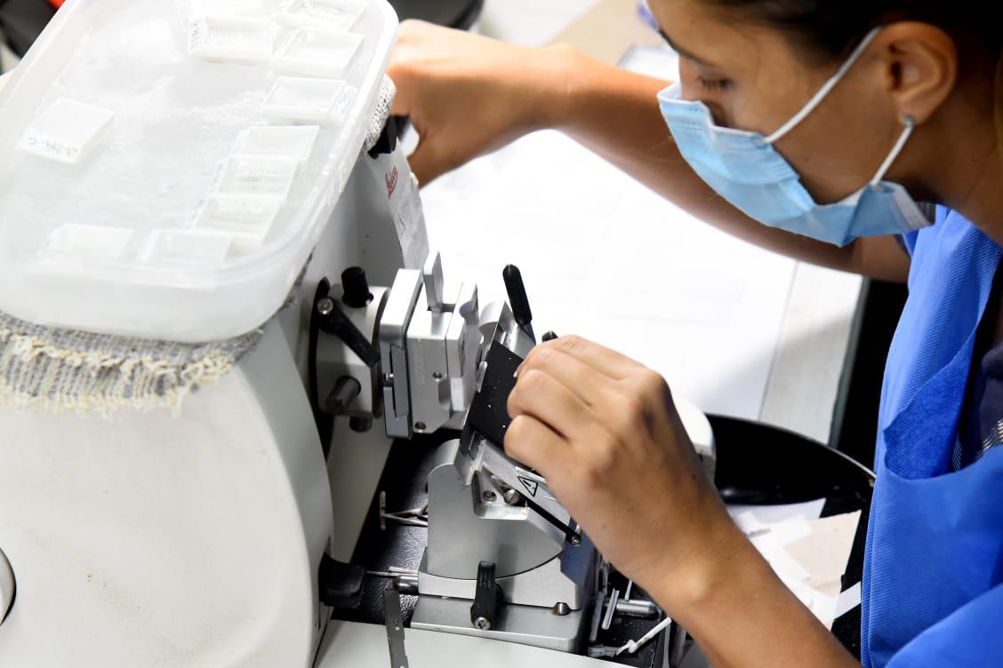 cáncer de cuello uterino 1