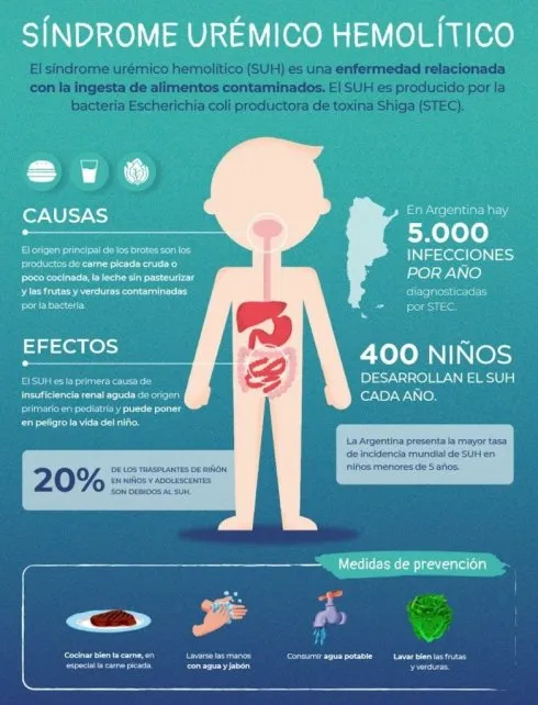 sindrome-uremico-hemolitico
