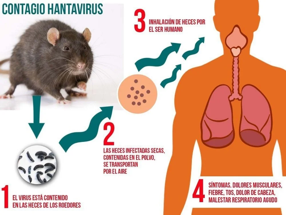 Hantavirus 1
