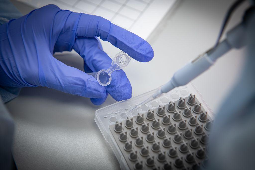 Ensayos con vacuna Argentina contra el covid