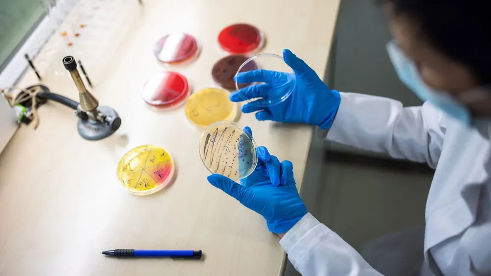 Síndrome Urémico 1